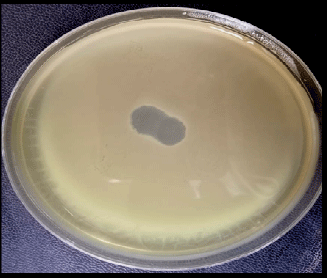 Image for - Isolation and Characterization of Pseudomonas aeruginosa and its Virulent Bacteriophages