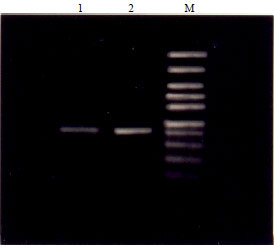 Image for - Development of Molecular Diagnosis by PCR for the Detection of Infection and Gene Expression for Nipah Virus (NiV)