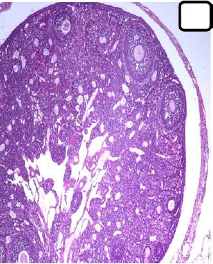 Image for - How Pectin Play a Role in Histological Changes by Monosodium Glutamate (MSG) in the Ovary of Mice?