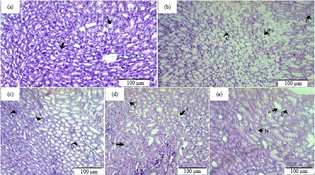 Image for - Effects of Nanoherbal Haramonting (Rhodomyrtus tomentosa) and Extra Virgin Olive Oil on Histology of Liver and Kidney of Preeclamptic Rats