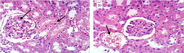 Image for - Suadian Acacia Gerrardii: Antidiabetic Effect in Rats Suffering from Diabetic Nephropathy and DNA Fingerprinting Using ISSR