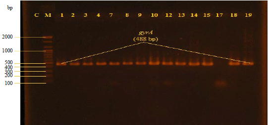 Image for - Molecular Detection of gyrA Gene in Salmonella enterica serovar Typhi Isolated from Typhoid Patients in Baghdad