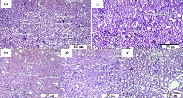 Image for - Effects of Nanoherbal Haramonting (Rhodomyrtus tomentosa) and Extra Virgin Olive Oil on Histology of Liver and Kidney of Preeclamptic Rats