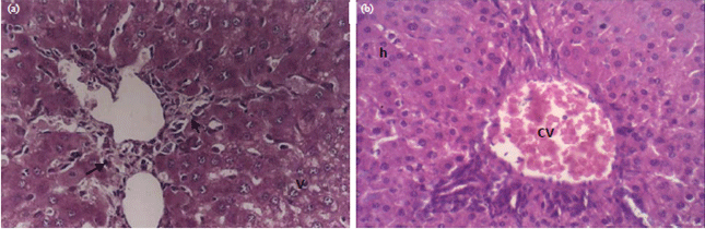 Image for - Hepatoprotective Impact of Geraniol Against CCl4-Induced Liver Fibrosis in Rats