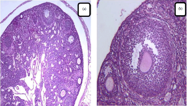 Image for - How Pectin Play a Role in Histological Changes by Monosodium Glutamate (MSG) in the Ovary of Mice?
