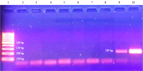 Image for - Toxoplasma gondii Infection in Cattle Egret (Bubulcus ibis): First Report from Shebin El-Kom, Menoufia Governorate, Egypt