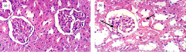 Image for - Suadian Acacia Gerrardii: Antidiabetic Effect in Rats Suffering from Diabetic Nephropathy and DNA Fingerprinting Using ISSR