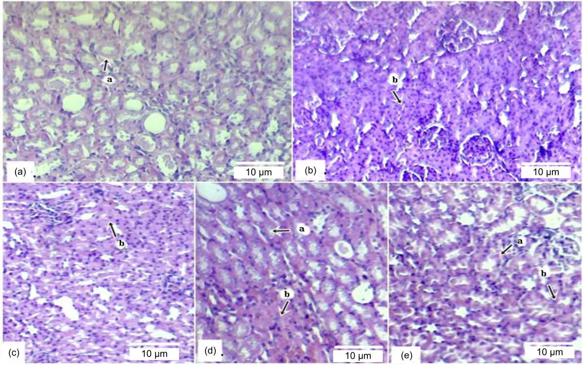 Image for - Effect of Andaliman (Zanthoxylum acanthopodium DC.) Methanol Extract on Rat’s Kidney and Liver Histology Induced by Benzopyrene