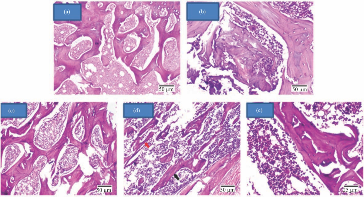 Image for - Salvia officinalis Extract and 17β-Estradiol Suppresses Ovariectomy Induced Osteoporosis in Female Rats