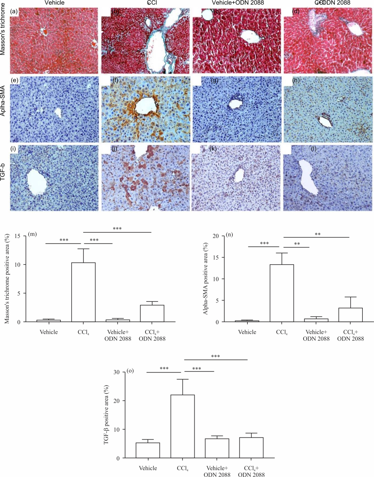 Image for - Therapeutic Impact of ODN2088 to Block TLR9 Activity in Induced Liver Fibrosis Mice