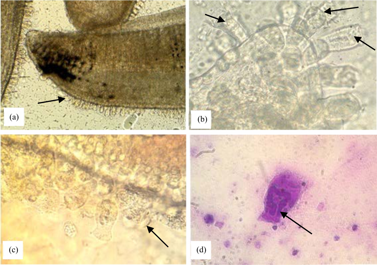 Image for - Control of Riboscyphidia sp. (Ciliate) Infection in Asian Sea Bass (Lates calcarifer), Cultivated in the Red Sea