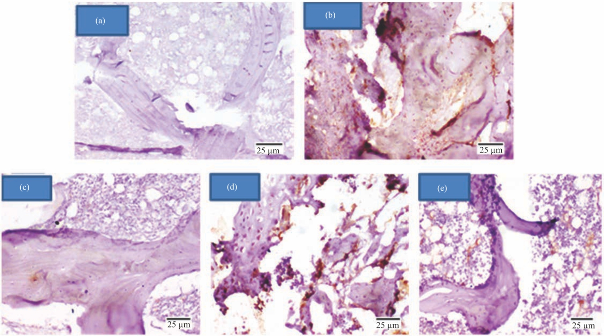 Image for - Salvia officinalis Extract and 17β-Estradiol Suppresses Ovariectomy Induced Osteoporosis in Female Rats