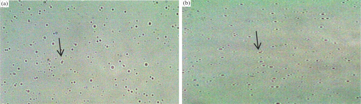 Image for - Characterization of Biofilm Producer Nanobacteria Isolated from Kidney Stones of Some Egyptian Patients
