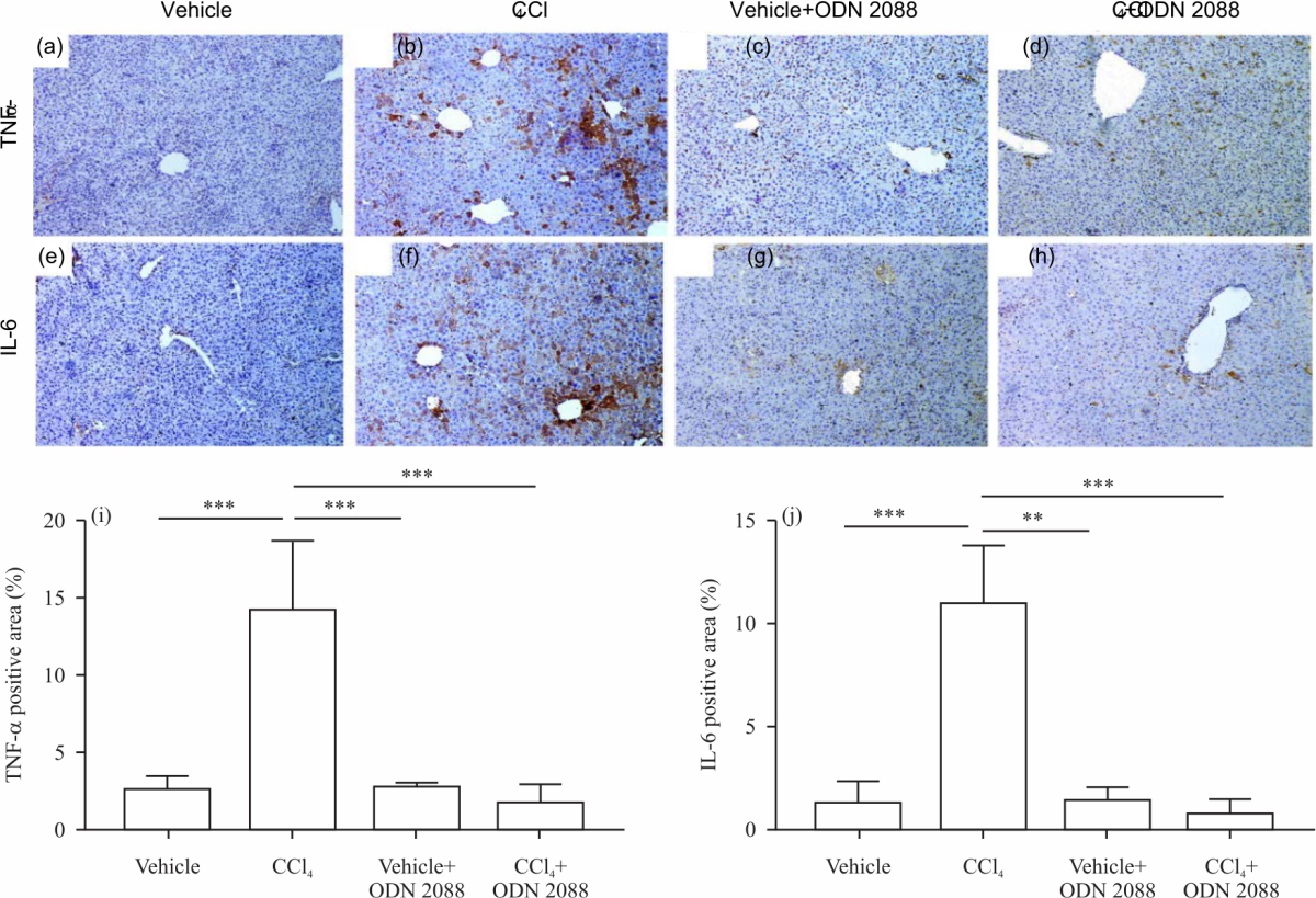 Image for - Therapeutic Impact of ODN2088 to Block TLR9 Activity in Induced Liver Fibrosis Mice