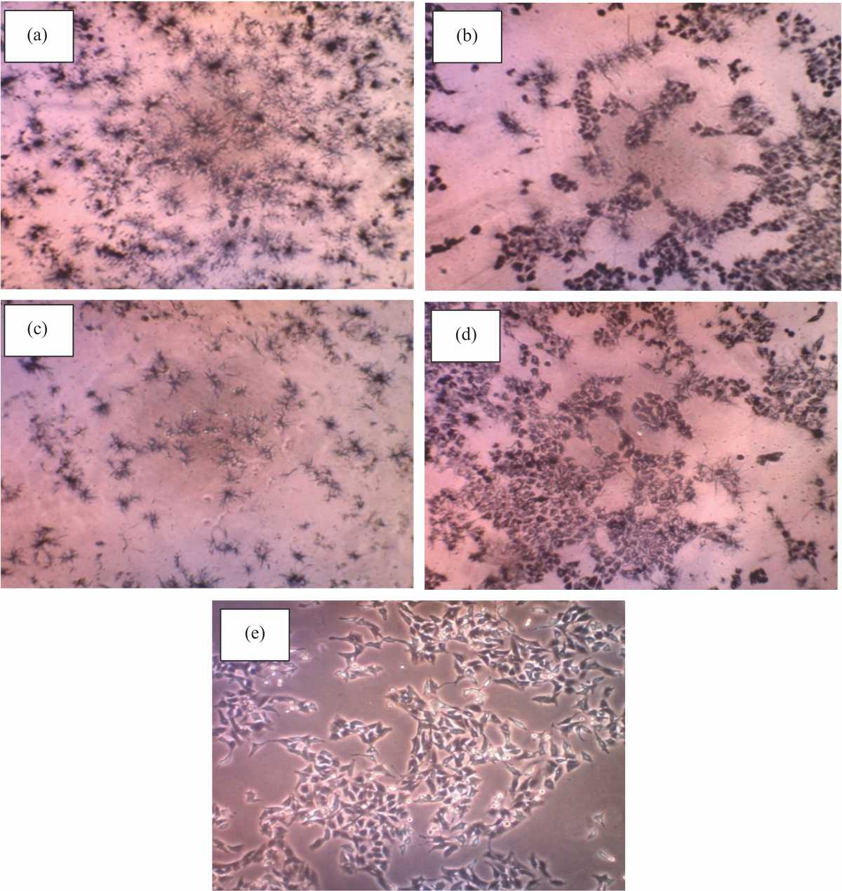 Inhibition of Human Cervical Cancer Hela Cell Line by Meat-Derived Lactic  Acid Bacteria of Lactobacillus plantarum IIA-1A5 and Lactobacillus  acidophilus IIA-2B4 - SciAlert Responsive Version