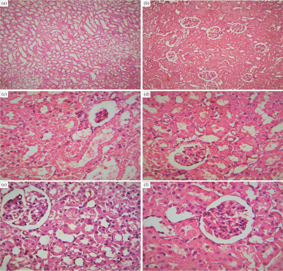 Image for - Nephroprotective Effect of Costus (Saussurea costus) Ethanolic Extract on Oxaliplatin®-induced Nephrotoxicity in Adult Male Wistar Rats