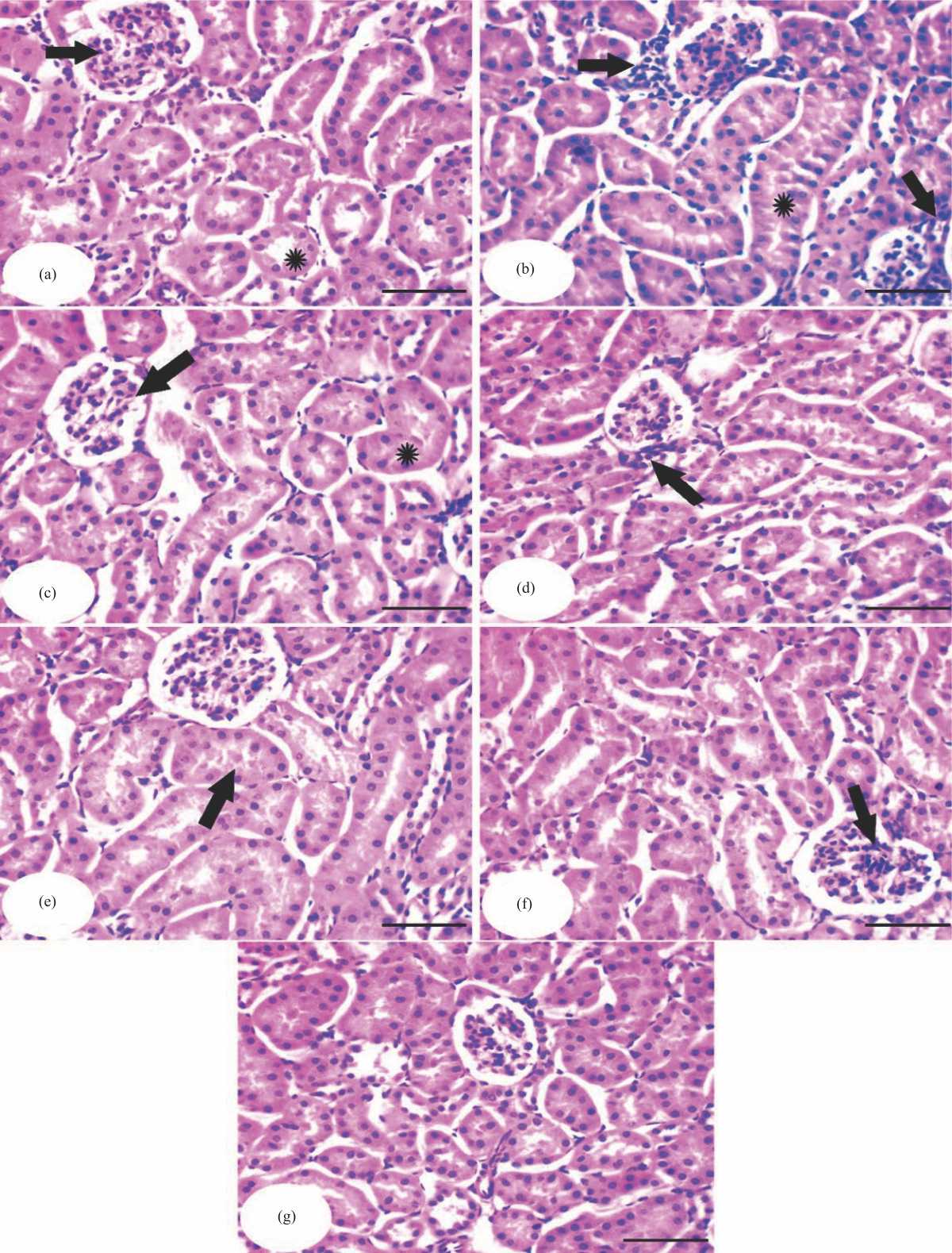 Image for - Hepatic and Renal Impacts of Lesinurad on Experimental Hyperuricemia: Biochemical, Molecular and Pathological Investigations