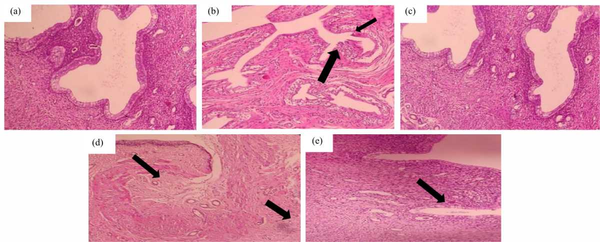 Image for - Evaluation of Matcha (Camellia sinensis) and Ashwagandha (Withania somnifera) Efficacy Against Utero-Ovarian Injury in Rats