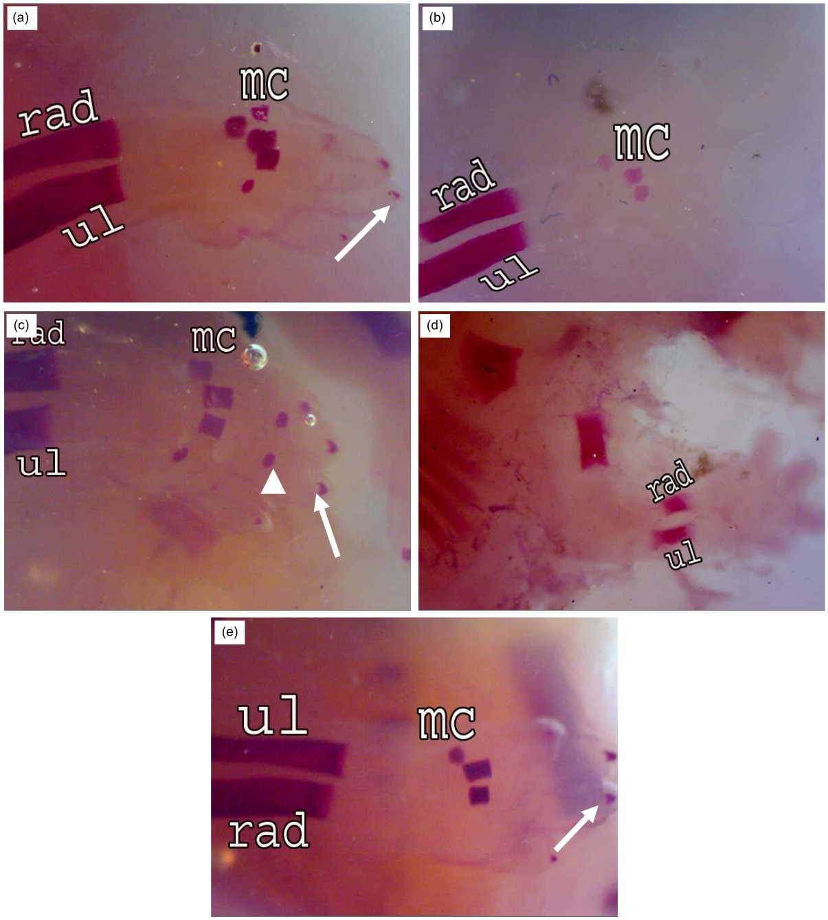 Image for - Effect of Bone Marrow Transplantation on the Fetal Skeleton of Maternally Irradiated Pregnant Rats