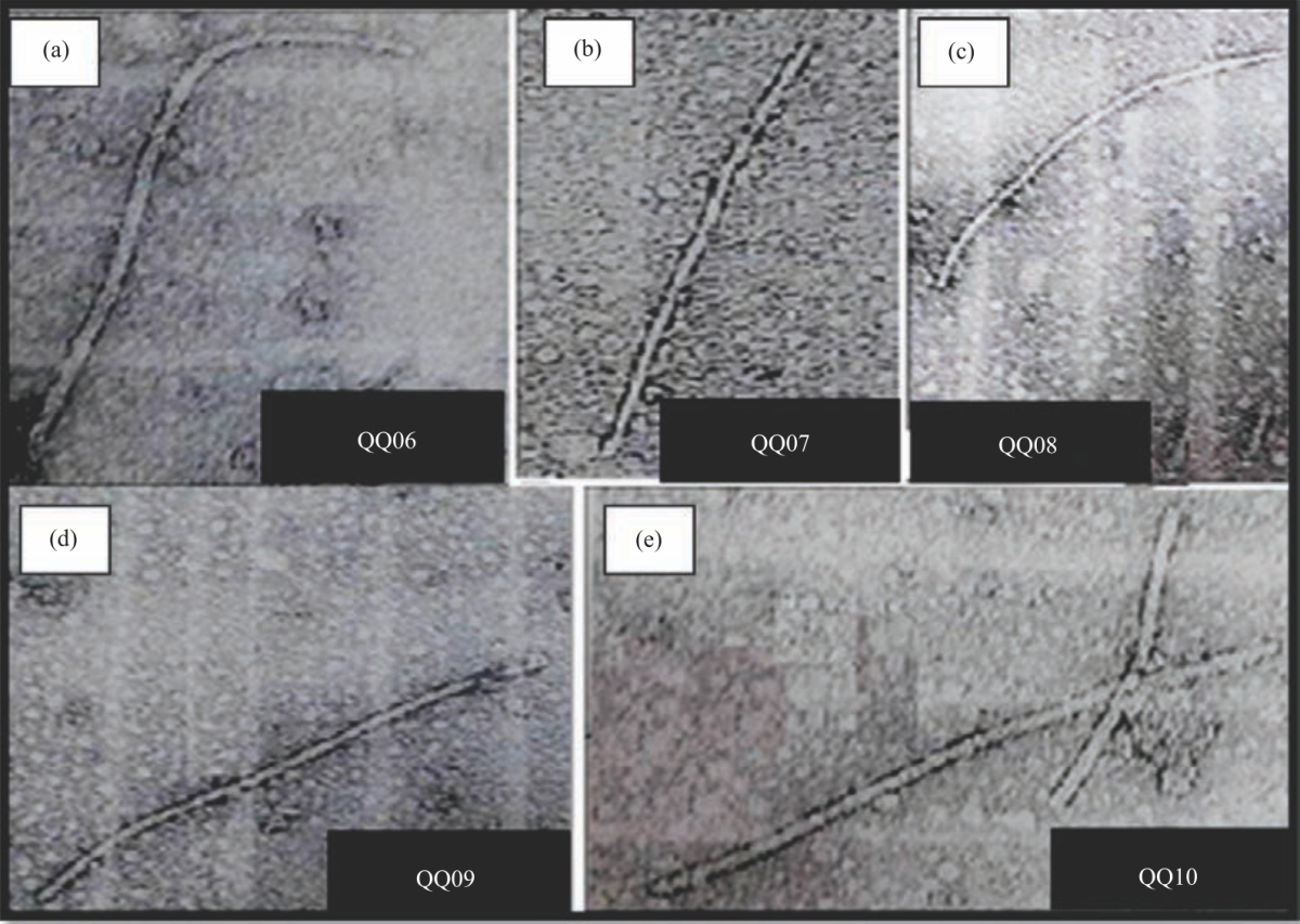 Image for - Isolation and Characterization of Antagonistic Activity of Some Streptomycetes and their Specific Actinophages from Soil