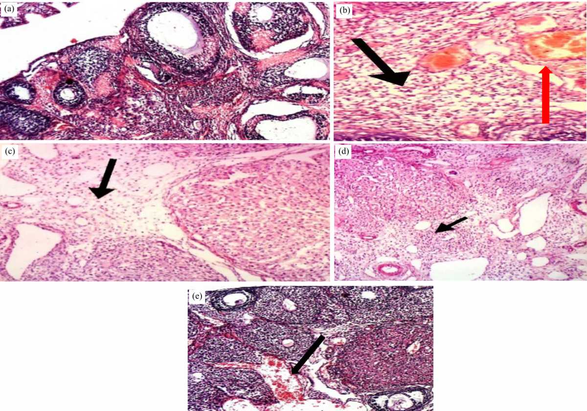 Image for - Evaluation of Matcha (Camellia sinensis) and Ashwagandha (Withania somnifera) Efficacy Against Utero-Ovarian Injury in Rats