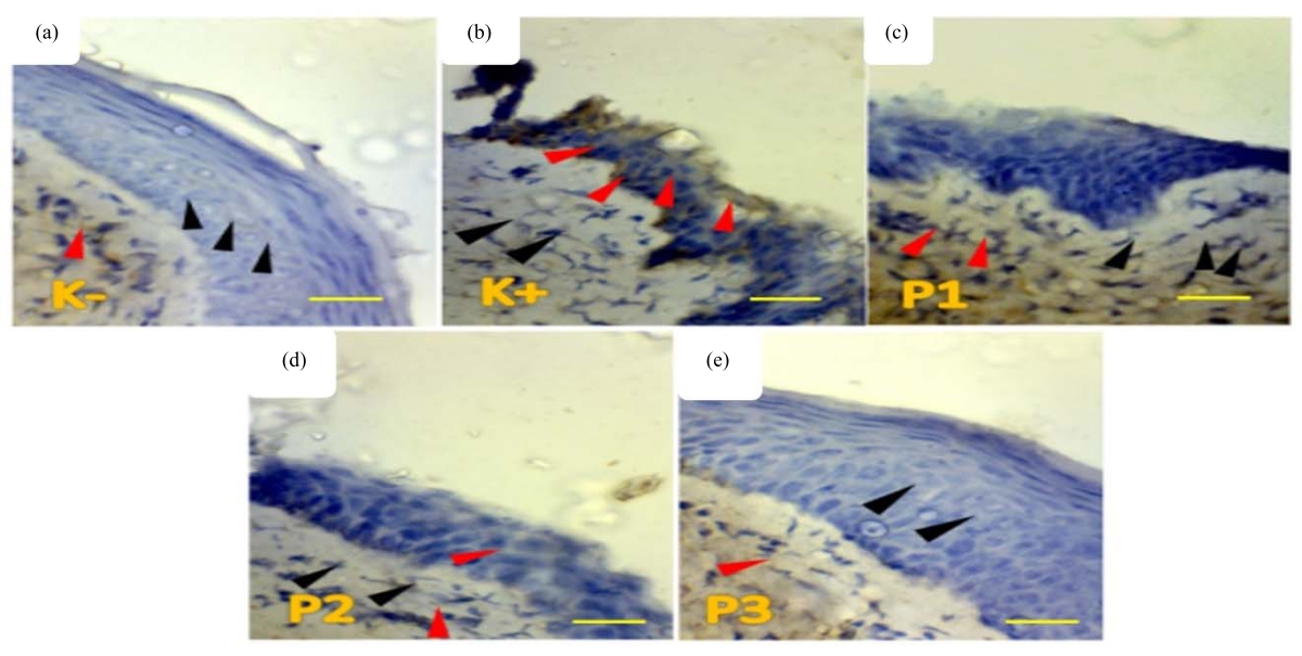Image for - Correlation of Myc Expression with Wee1 Expression by Zanthoxylum acanthopodium in Cervical Carcinoma Histology
