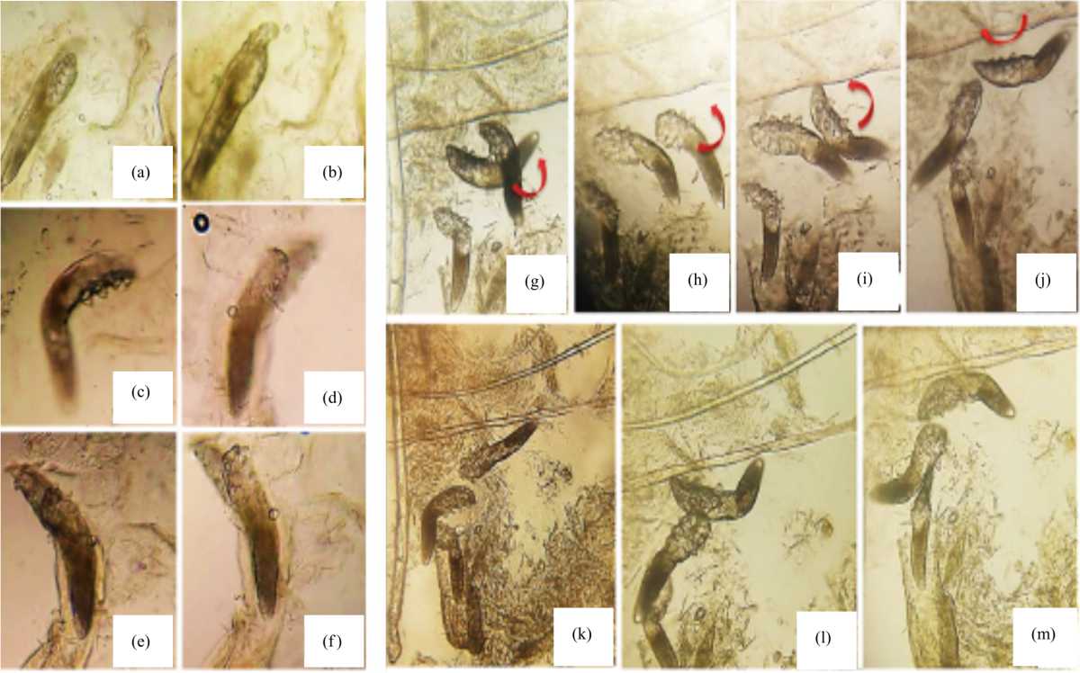 Demodex Mites in Relation to the Degree of Acne Vulgaris among Egyptian ...