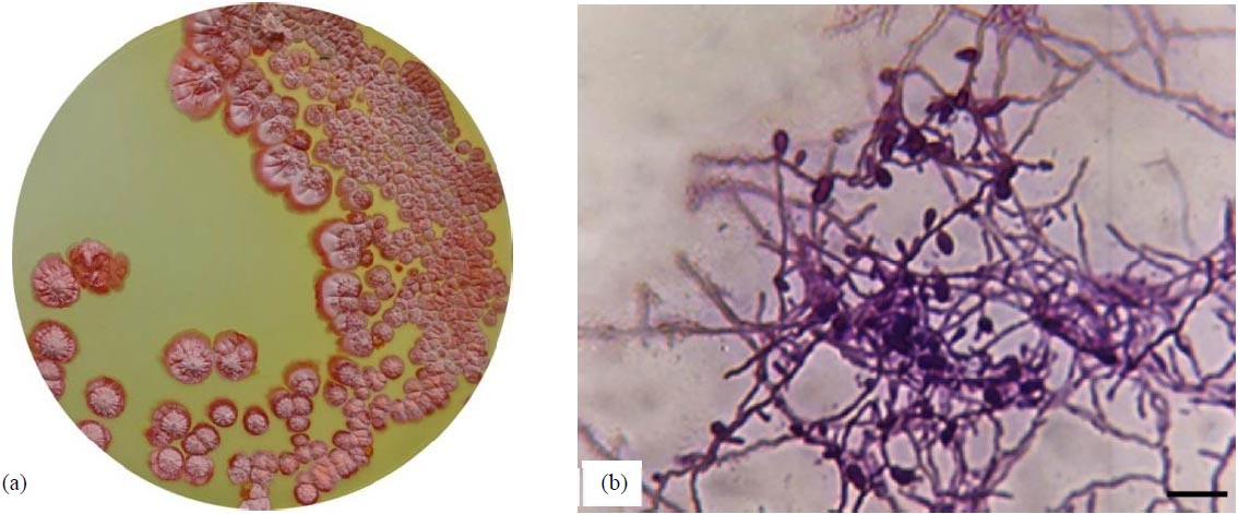 Image for - Antibacterial and Anticancer Properties of Microbispora sp., AL22: An Endophyte of Alpinia galanga (L.) Willd