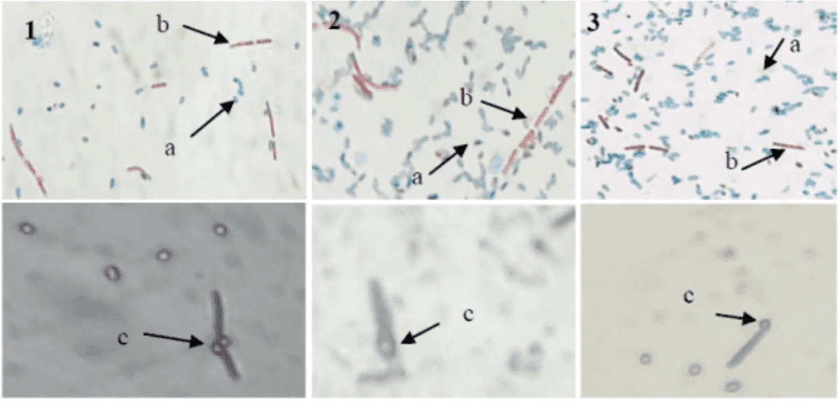 Image for - Phenotypic Characterization and Identification of Potential L-Asparaginase-Producing Thermohalophilic Bacteria from Wawolesea Hot Spring, North Konawe, Southeast Sulawesi, Indonesia