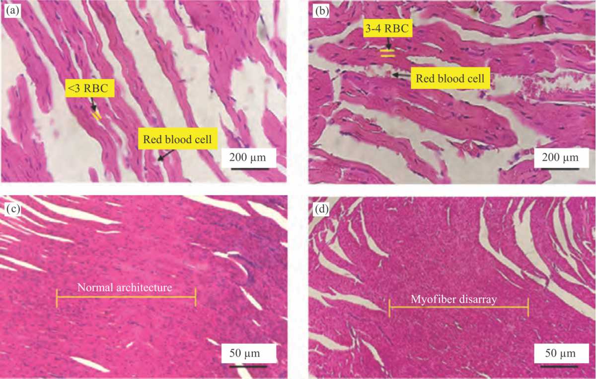 Image for - Moringa oleifera Leaves Extract Alters Exercise-Induced Cardiac Hypertrophy Adaptation
