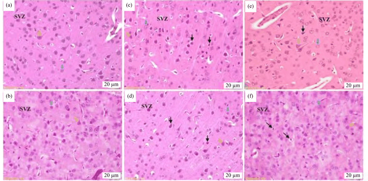 Image for - Nanocurcumin, Promising Potential Protective Agent Against Histopathological Damage in the Cerebral Cortex of Mice Induced by Aluminum Chloride