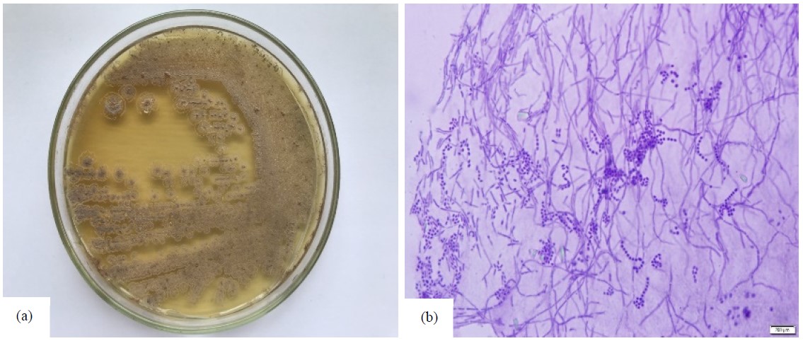 Image for - Antioxidant and Antibacterial Properties of 1,3-Dihydroxy-,2', 2'-Dimethylpyrano-(5,6)-Xanthone from Streptomyces sp. SU84