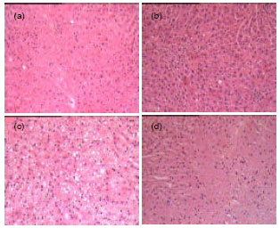Image for - Reduction of Carbon Tetrachloride-Induced Rat Liver Injury by Coffee and Green Tea