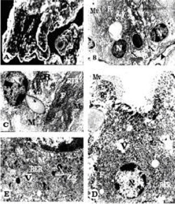 Image for - Ultrastructural Changes in Hepatopancreas of Palaemon serratus, Following Treatment with Petroleum Carcinogenic Compounds