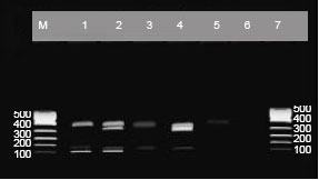 Image for - Selective Amplification of SEA, SEB and SEC Genes by Multiplex PCR for Rapid Detection of Staphylococcus aureus
