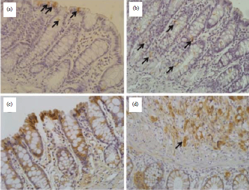 Image for - Fermented Camel (Camelus dromedarius) and Bovine Milk Attenuate Azoxymethane-induced Colonic Aberrant Crypt Foci in Fischer 344 Rats