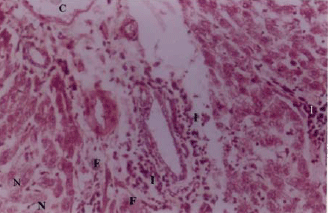 Image for - Structural Changes in Adult Rat Liver Following Cadmium Treatment