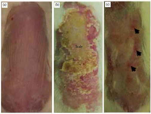 Image for - Photoprotective Effects of Oral L-Glutathione Supplementation on Epidermal Hyperplasia in UVB Irradiated Balb/C Mice