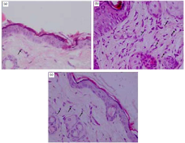 Image for - Photoprotective Effects of Oral L-Glutathione Supplementation on Epidermal Hyperplasia in UVB Irradiated Balb/C Mice