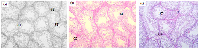 Image for - Semen Quality, Fertility and Testicular Histology of Rabbit Bucks Orally Administrated with Ethanolic Grape Seed Extract