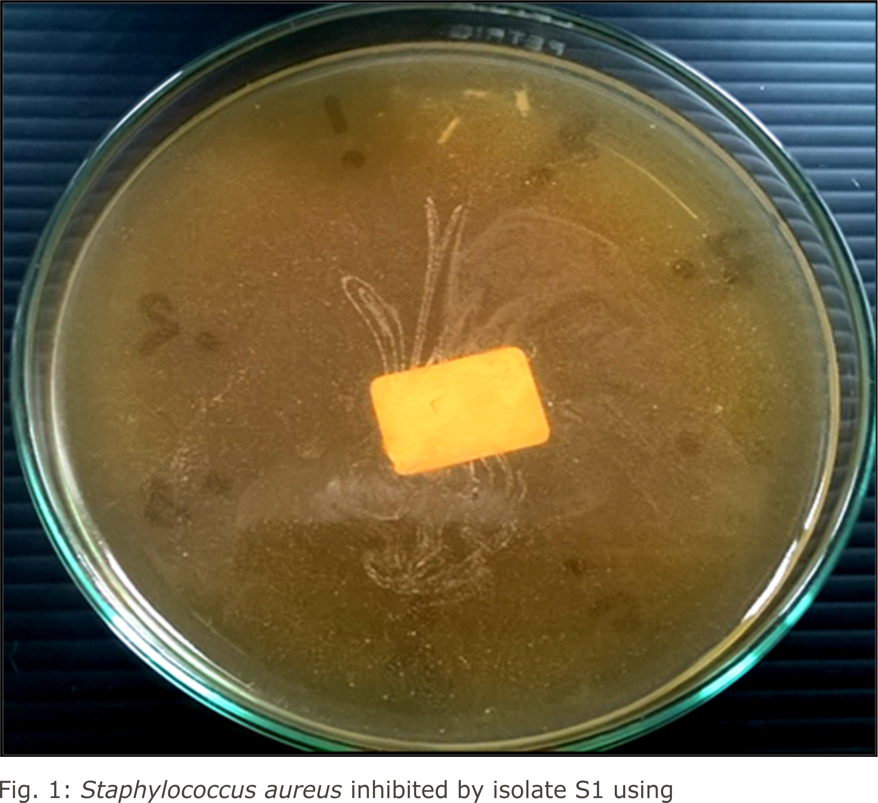 Image for - The Efficiency of Lactic Acid Bacteria Isolated from Pickled Local Vegetables to Inhibit Pathogenic Bacteria