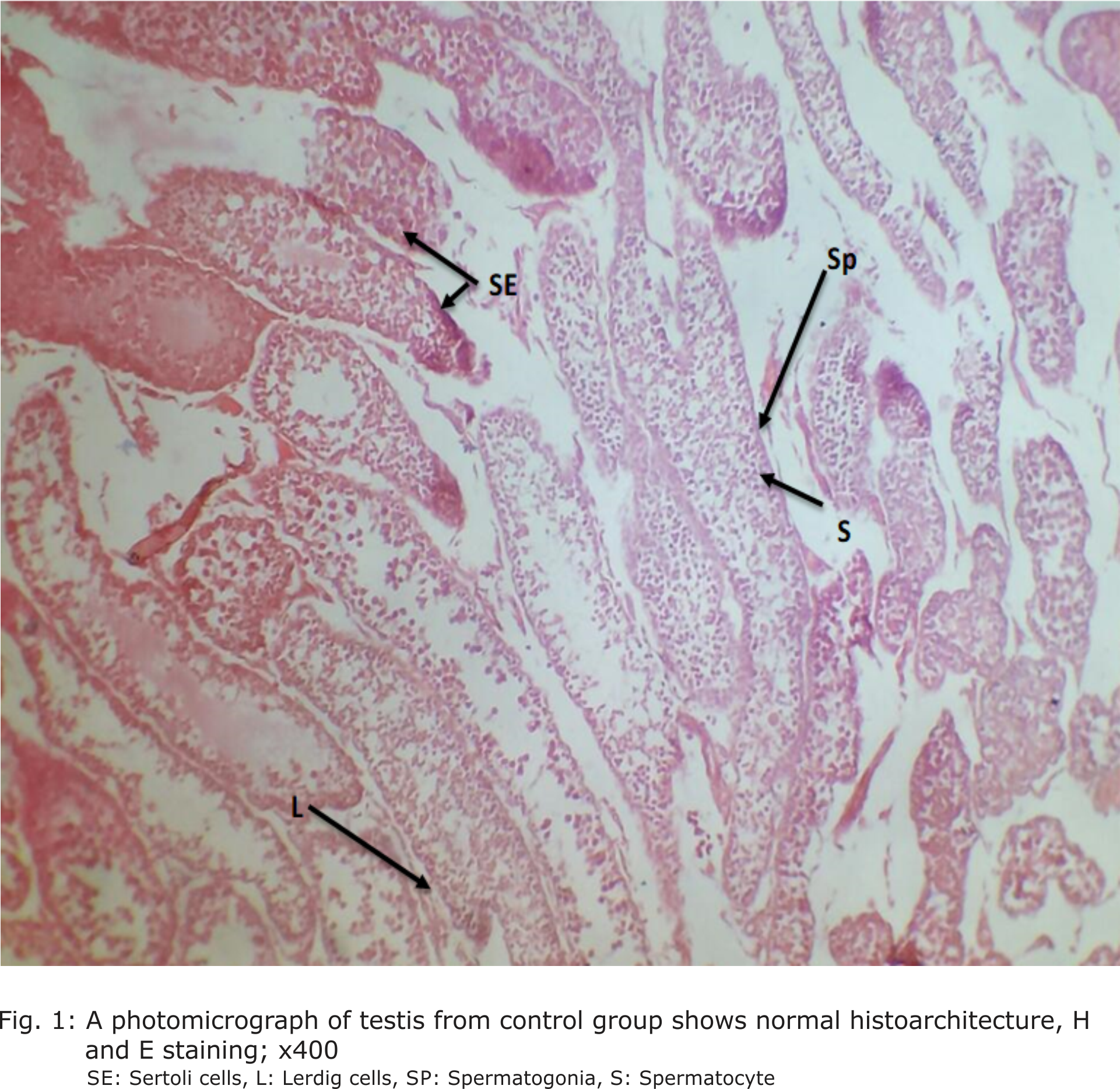 Fig. 1: A photomicrograph of testis from control group shows normal histoarchitecture, H and E staining; x400. SE: Sertoli cells, L: Lerdig cells, SP: Spermatogonia, S: Spermatocyte