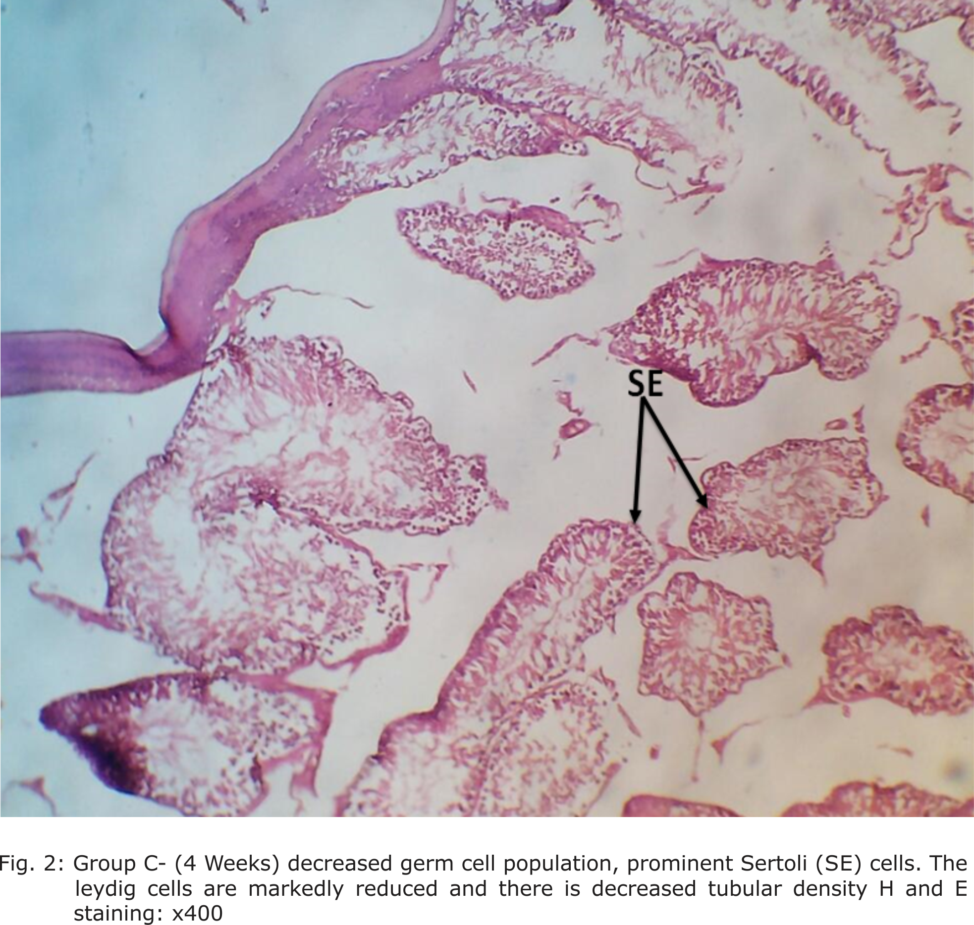 Fig. 2: Group C- (4 Weeks) decreased germ cell population, prominent Sertoli (SE) cells. The leydig cells are markedly reduced and there is decreased tubular density H and E staining: x400