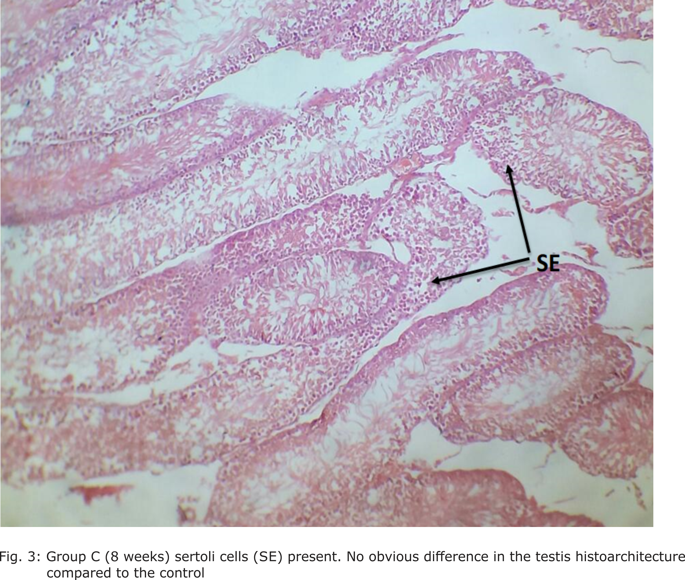 Fig. 3: Group C (8 weeks) sertoli cells (SE) present. No obvious difference in the testis histoarchitecture compared to the control