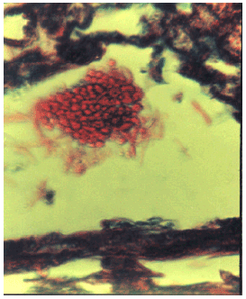 Image for - Histopathological Study of Soybean Rust and Anthurium Leaf Blight in the Philippines