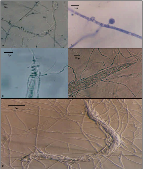 Image for - Antagonistic Effect of Some Species of Pleurotus on the Root-knot Nematode, Meloidogyne javanica in vitro