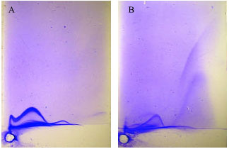 Image for - Comparison of Two Egyptian Isolates of Spiroplasma citri by Crossed Immunoelectrophoresis and Polyacrylamide Gel Electrophoresis of Cell Proteins