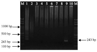 Image for - Specific Detection of Peronospora tabacina by PCR-amplified rDNA Sequences
