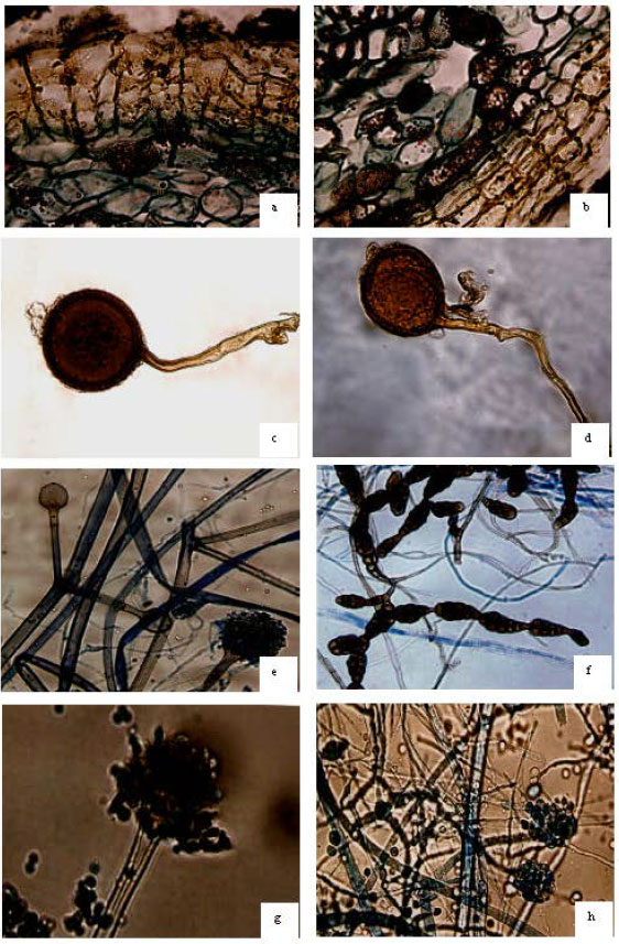Image for - Microbial Associates of Hippophae rhamnoides (Seabuckthorn)