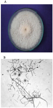 Image for - High Incidence of Fusarium verticillioides in Animal and Poultry Feed Mixtures Produced in Karnataka, India